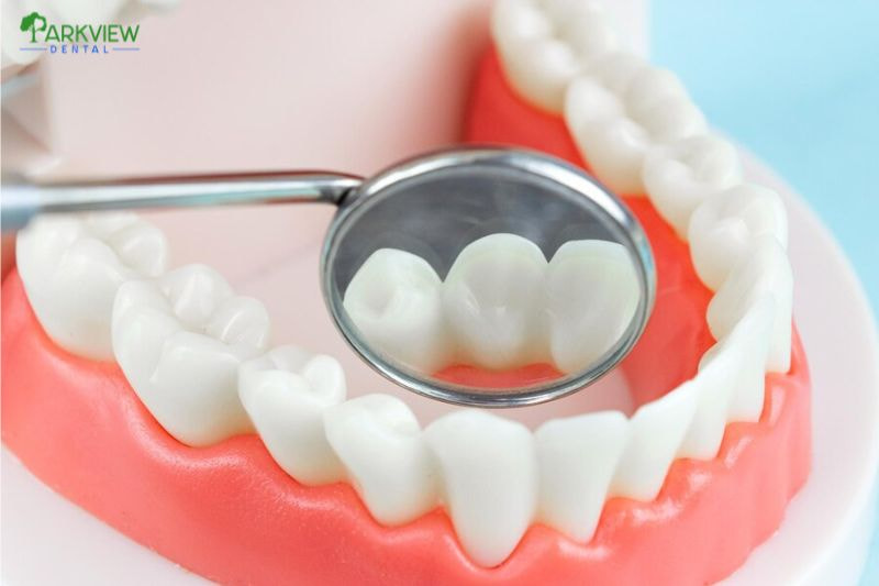 Bọc răng sứ toàn sứ giá dao động từ 3.000.000 - 10.000.000 VND/răng