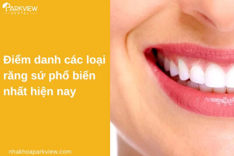 các loại răng sứ