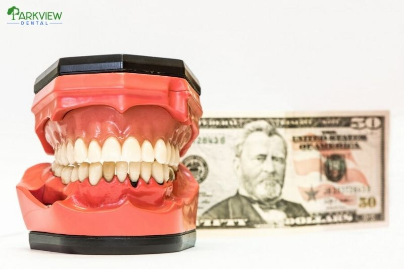 Các yếu tố ảnh hưởng đến chi phí răng sứ