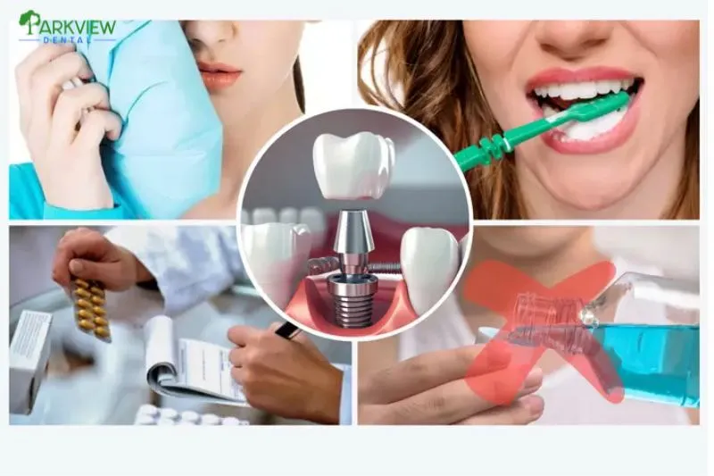 Cách giảm đau khi trồng răng Implant