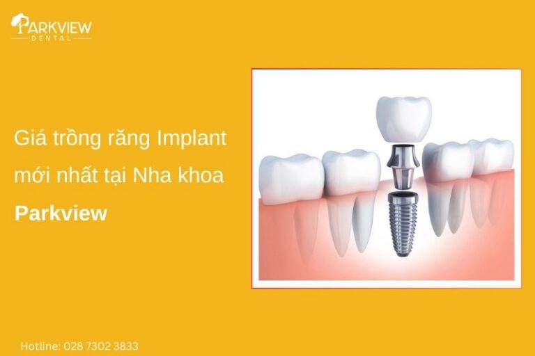 giá trồng răng implant