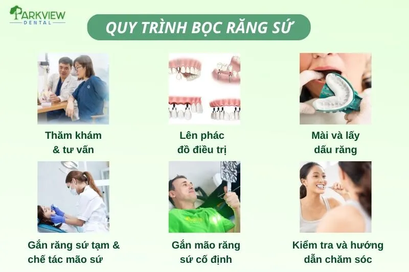 Quy trình bọc răng sứ chuẩn y khoa tại Nha Khoa Parkview