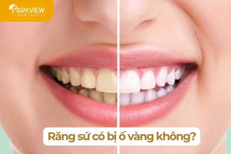 răng sứ có bị ố vàng không