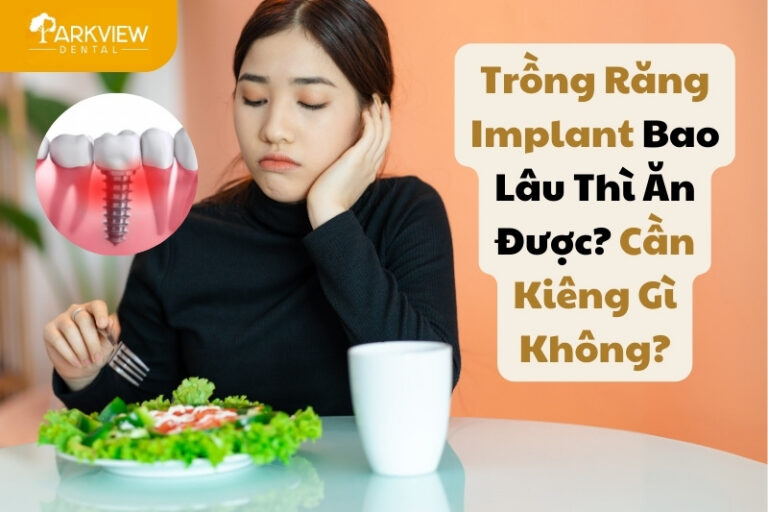 trồng răng implant bao lâu thì ăn được