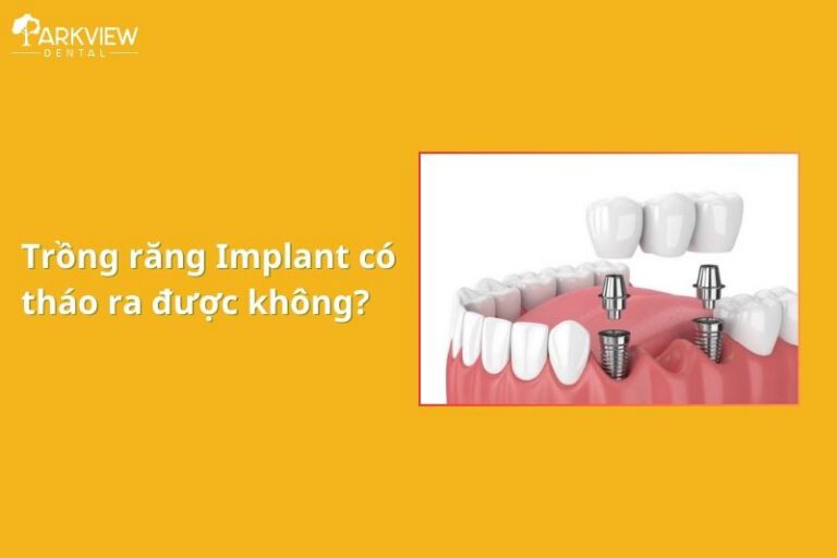 trồng răng implant có tháo ra được không