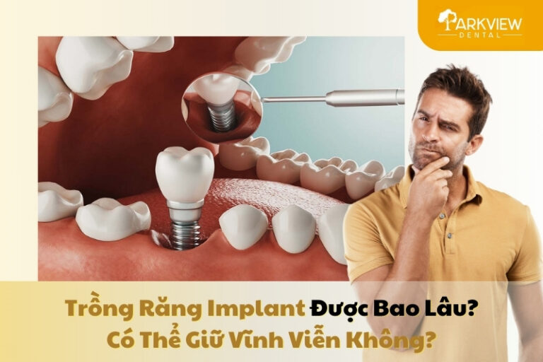 trồng răng implant được bao lâu