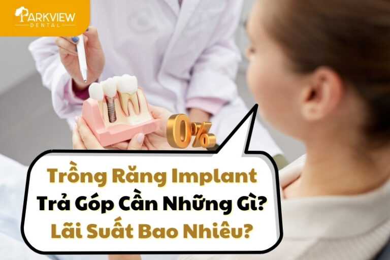 trồng răng implant trả góp