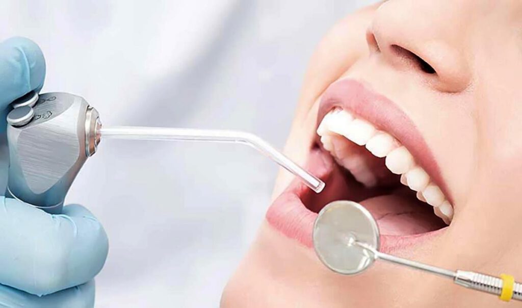 Trồng răng Implant