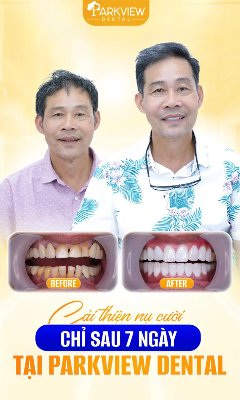 Răng Ố Vàng, Thưa Kẽ, Lung Lay – Giải Pháp Phục Hồi Ăn Nhai Chắc Chắn & Thẩm Mỹ Tại Parkview Dental