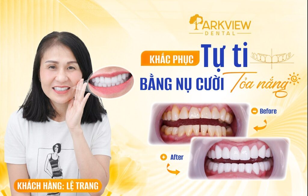 Khách Hàng Trang Lê Chia Sẻ Trải Nghiệm Khi Được Người Nhà Giới Thiệu