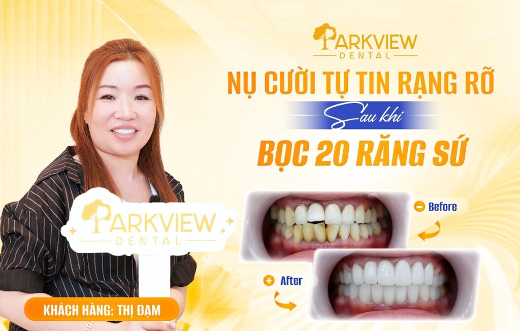 Đau Răng, Sưng Nướu Kéo Dài Và Cái Kết Sau Khi Làm Răng Tại Parkview